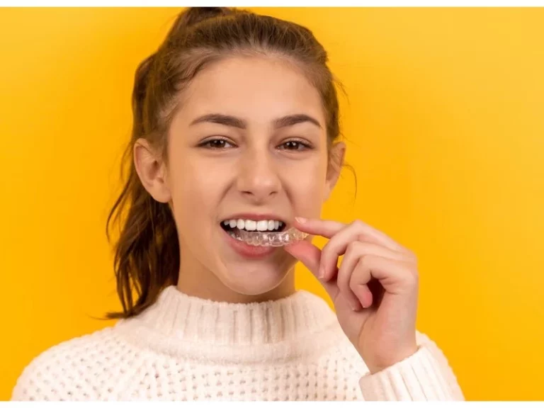 Cara Menggunakan Snap On Smile yang Benar