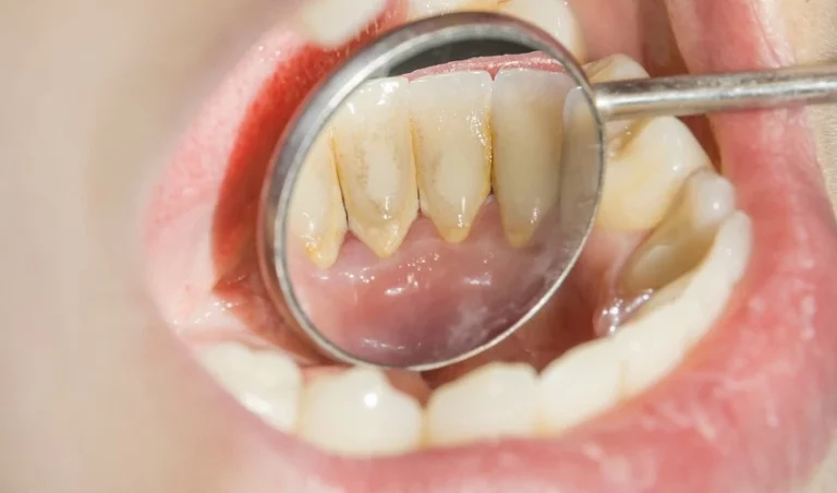 Cara Daftar Dokter Gigi BPJS Online